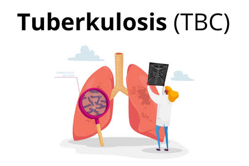 Program TB Masih Sulit